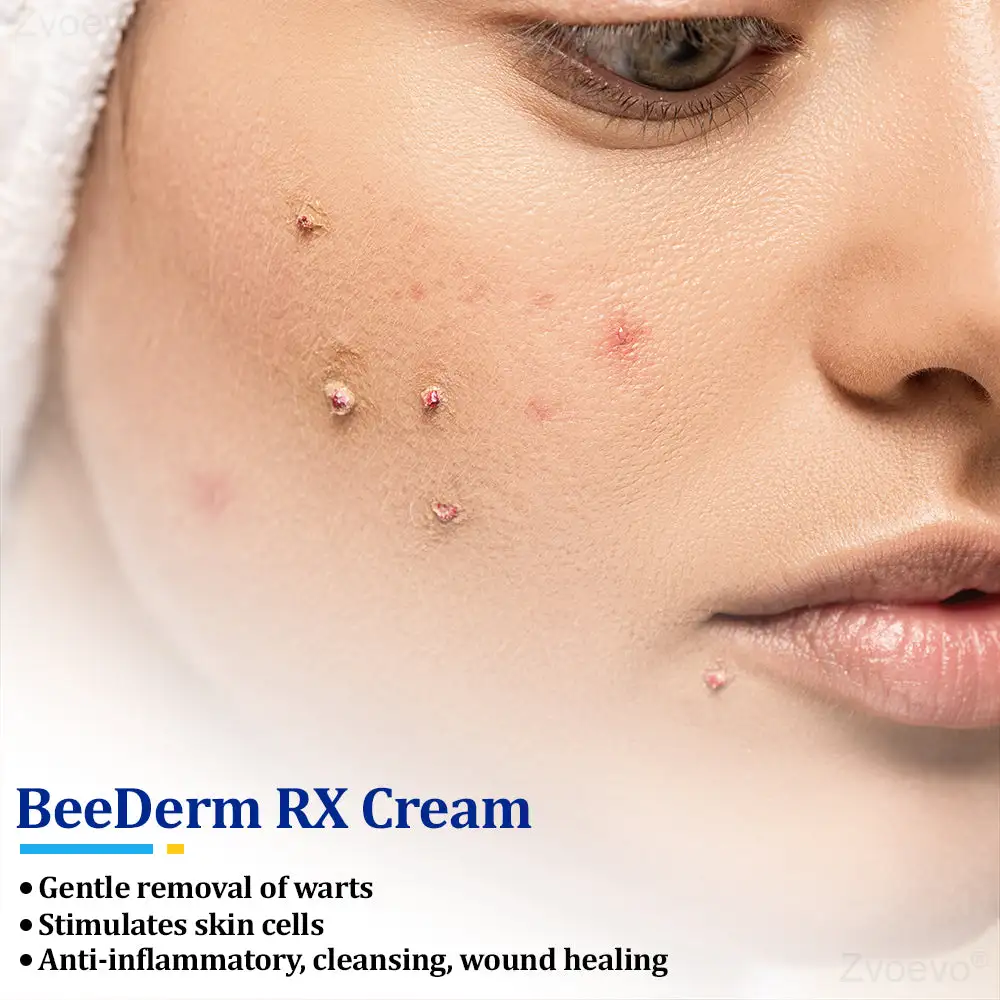 Zvoevo® BeeDerm RX Cream