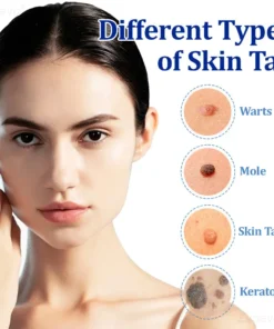 Zvoevo® BeeDerm RX Cream