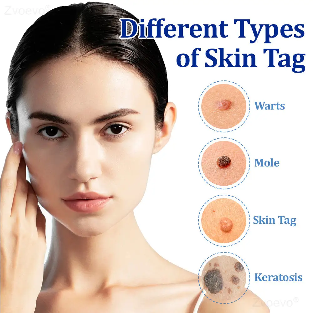 Zvoevo® BeeDerm RX Cream