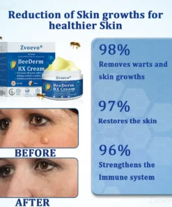 Zvoevo® BeeDerm RX Cream