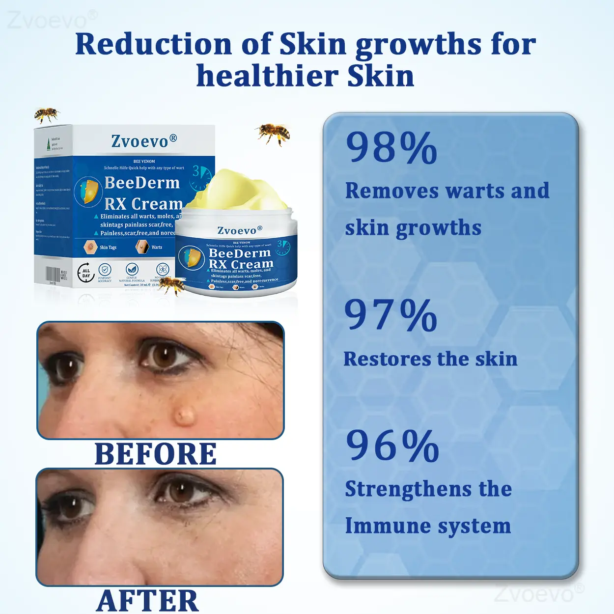 Zvoevo® BeeDerm RX Cream
