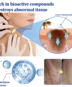 Zvoevo® BeeDerm RX Cream