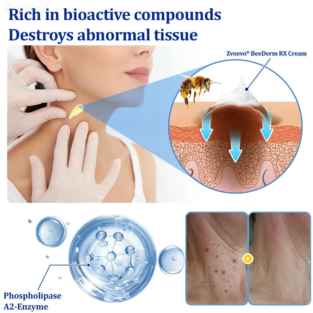 Zvoevo® BeeDerm RX Cream