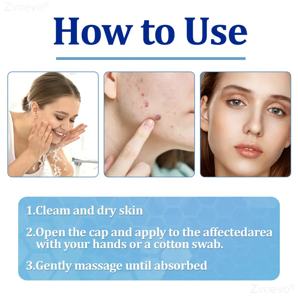 Zvoevo® BeeDerm RX Cream