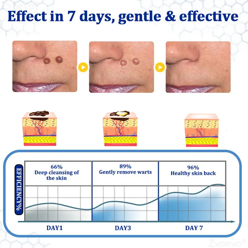Zvoevo® BeeDerm RX Cream