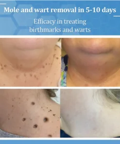 Zvoevo® BeeDerm RX Cream