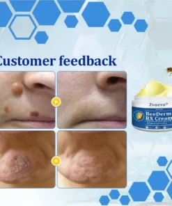 Zvoevo® BeeDerm RX Cream