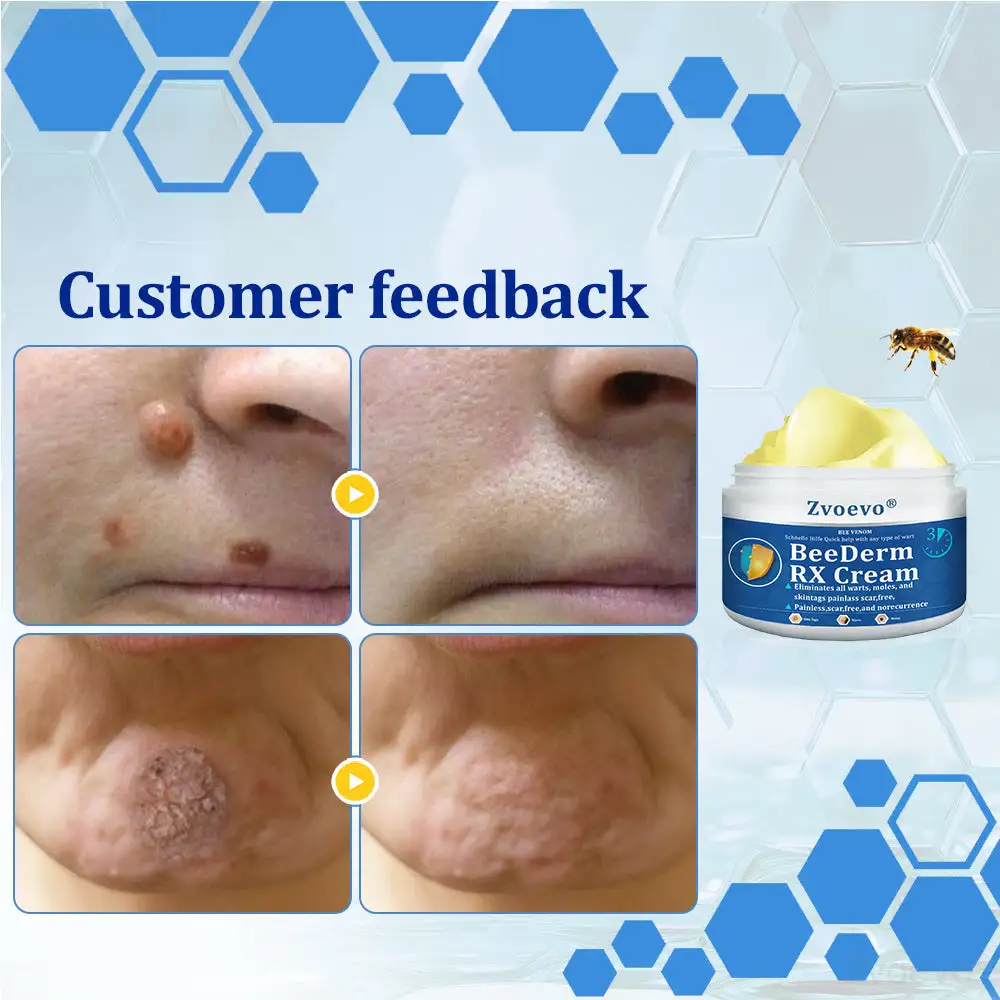 Zvoevo® BeeDerm RX Cream