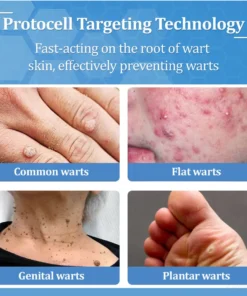 Zvoevo® BeeDerm RX Cream