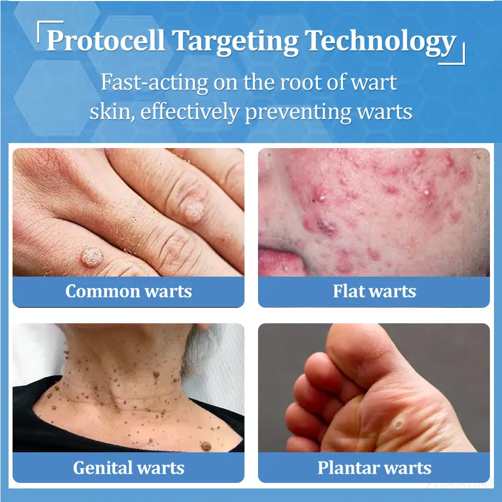 Zvoevo® BeeDerm RX Cream