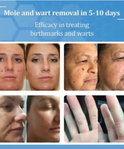 Zvoevo® BeeDerm RX Cream