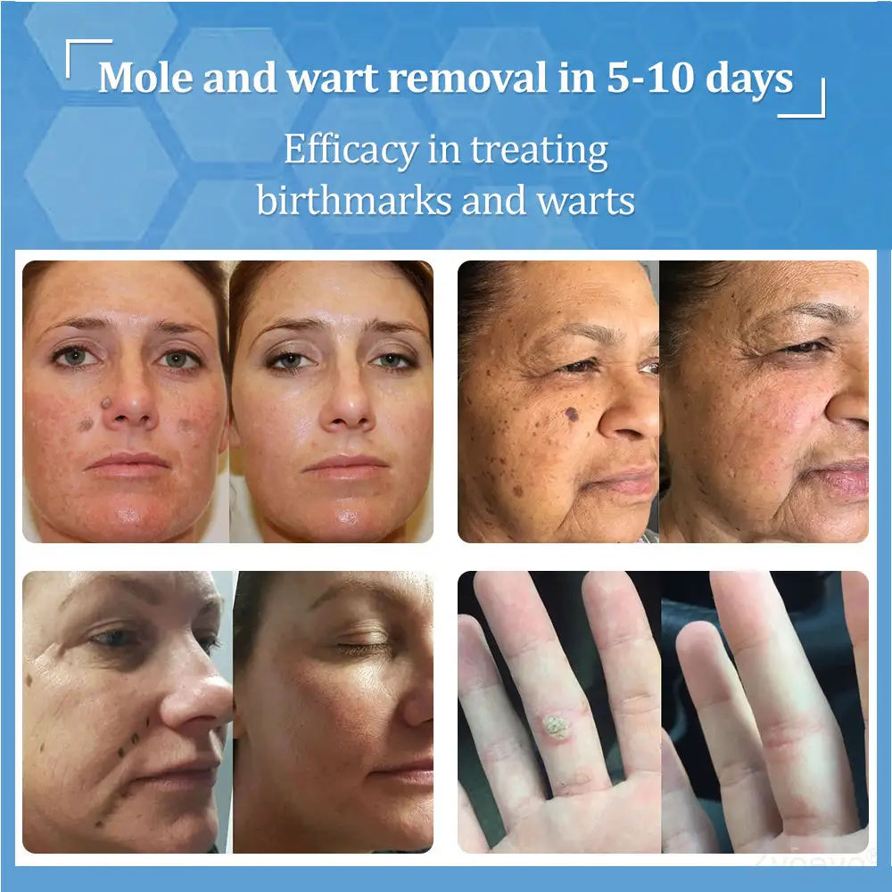 Zvoevo® BeeDerm RX Cream