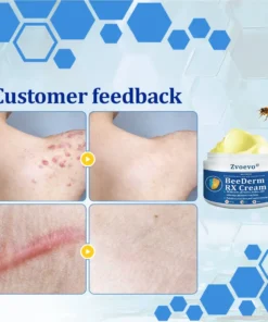 Zvoevo® BeeDerm RX Cream