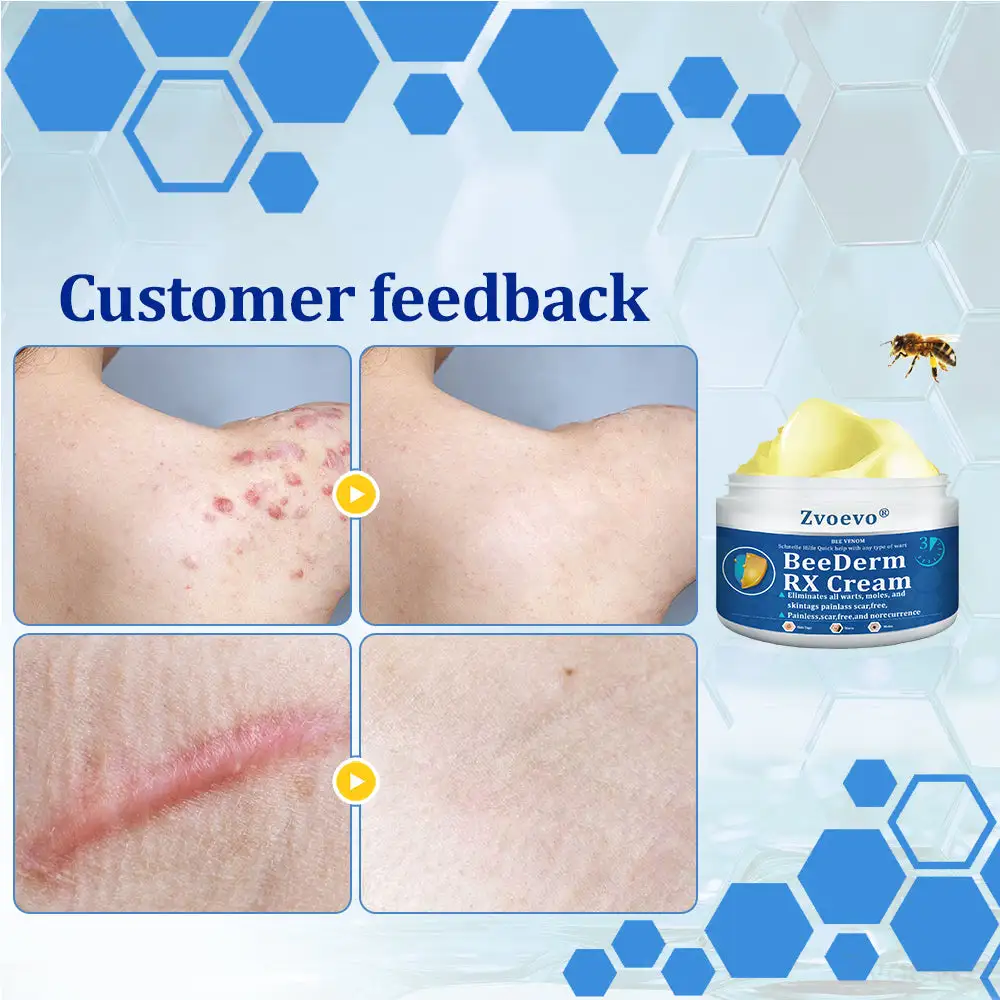 Zvoevo® BeeDerm RX Cream