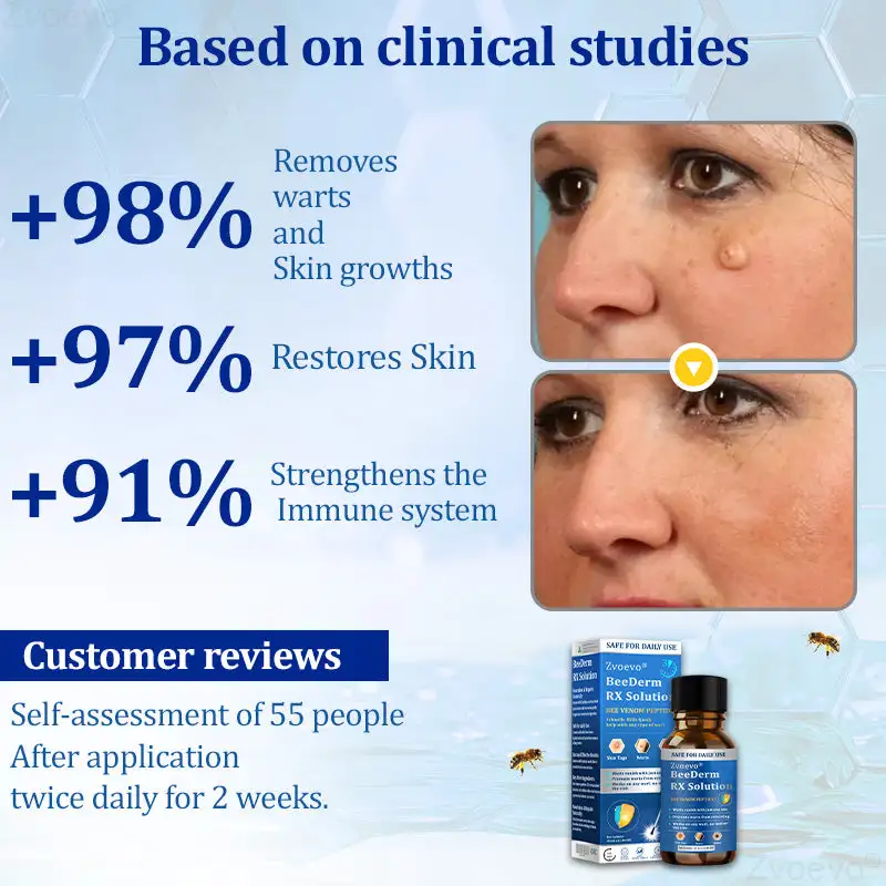 Zvoevo® BeeDerm RX Solution