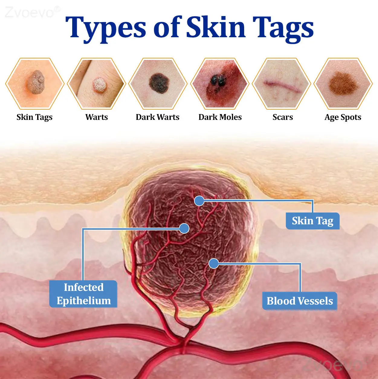 Zvoevo® BeeDerm RX Solution