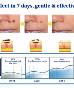 Zvoevo® BeeDerm RX Solution