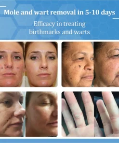 Zvoevo® BeeDerm RX Solution