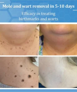 Zvoevo® BeeDerm RX Solution