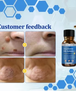 Zvoevo® BeeDerm RX Solution