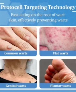 Zvoevo® BeeDerm RX Solution