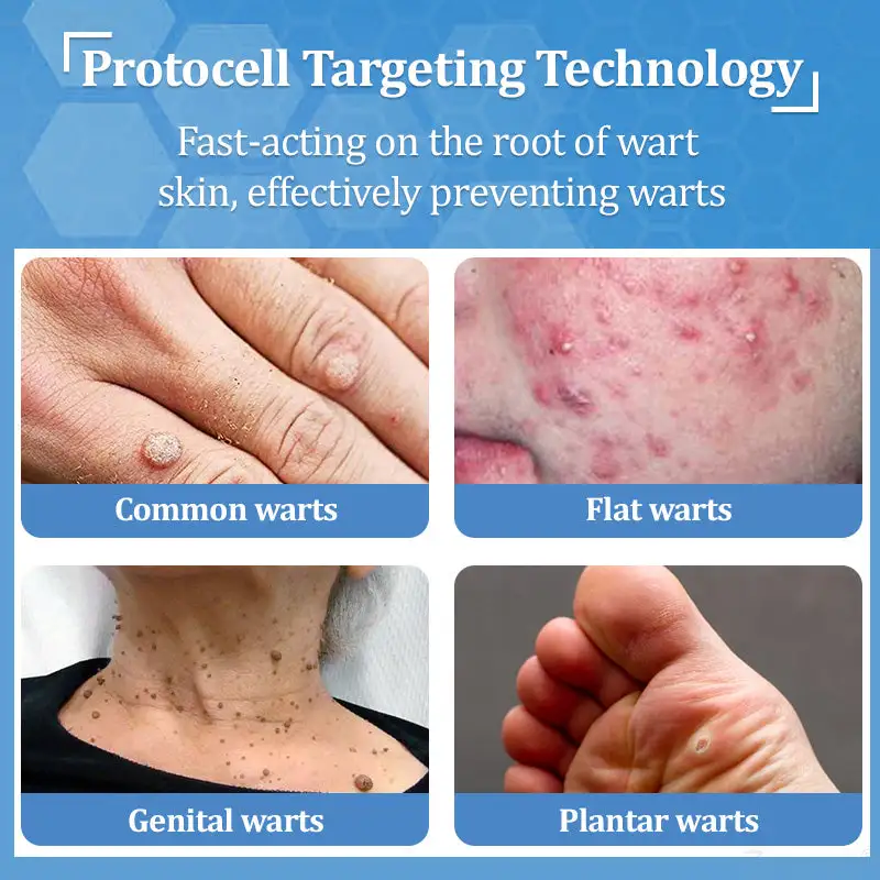 Zvoevo® BeeDerm RX Solution