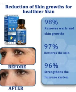 Zvoevo® BeeDerm RX Solution