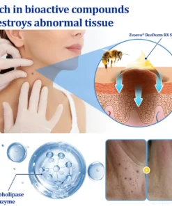 Zvoevo® BeeDerm RX Solution