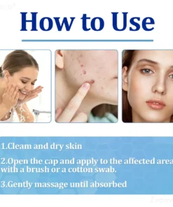 Zvoevo® BeeDerm RX Solution