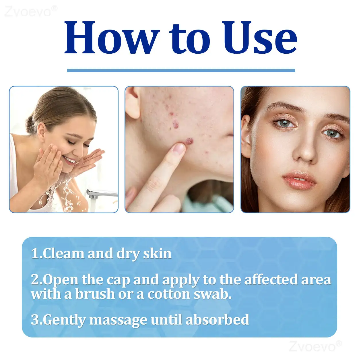 Zvoevo® BeeDerm RX Solution