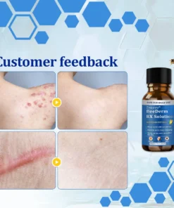 Zvoevo® BeeDerm RX Solution