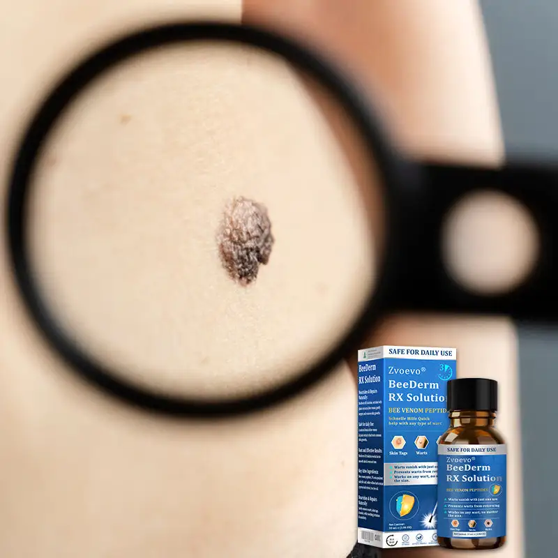 Zvoevo® BeeDerm RX Solution