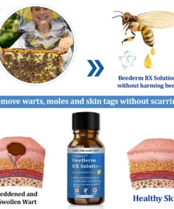 Zvoevo® BeeDerm RX Solution