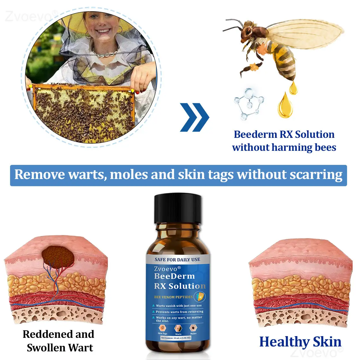 Zvoevo® BeeDerm RX Solution
