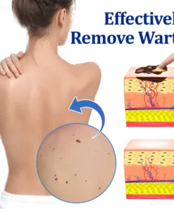 Zvoevo® BeeDerm RX Solution