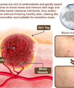Zvoevo® Black Rice Skin Repair Essence Cream