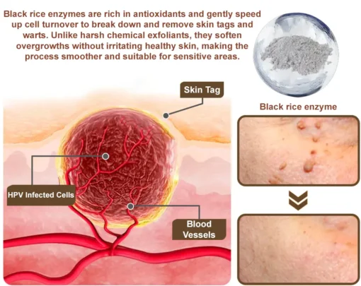 Zvoevo® Black Rice Skin Repair Essence Cream