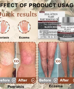 Zvoevo® Black Rice Skin Repair Essence Cream