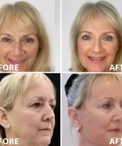 [Zvoevo® Official] 50% OFF Calcium Firming Stick | Anti-Aging, Firming & Wrinkle Care