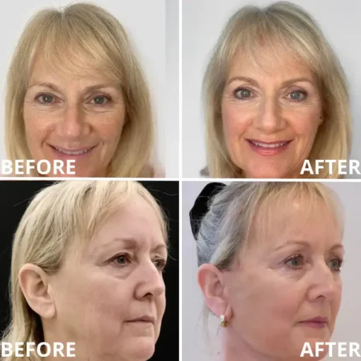 [Zvoevo® Official] 50% OFF Calcium Firming Stick | Anti-Aging, Firming & Wrinkle Care
