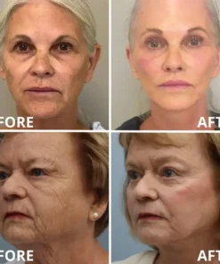 [Zvoevo® Official] 50% OFF Calcium Firming Stick | Anti-Aging, Firming & Wrinkle Care