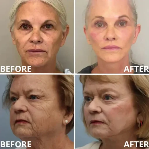 [Zvoevo® Official] 50% OFF Calcium Firming Stick | Anti-Aging, Firming & Wrinkle Care
