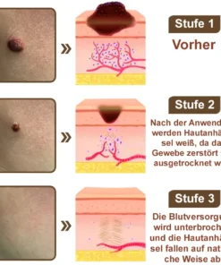 Zvoevo® Schwarzer Reis Hautreparatur Essenzcreme