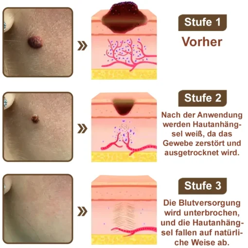 Zvoevo® Schwarzer Reis Hautreparatur Essenzcreme