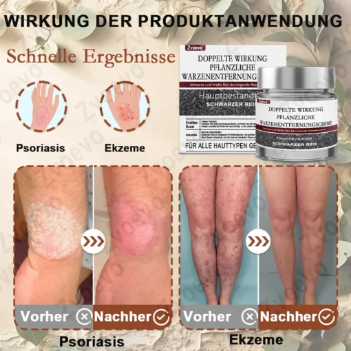 Zvoevo® Schwarzer Reis Hautreparatur Essenzcreme