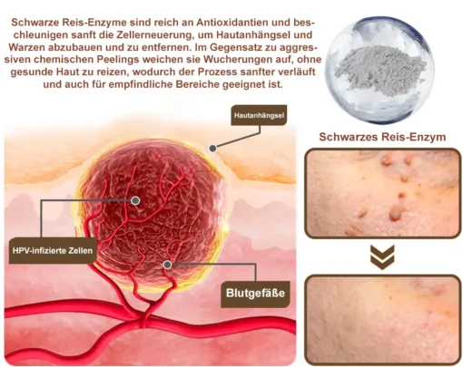 Zvoevo® Schwarzer Reis Hautreparatur Essenzcreme