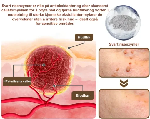Zvoevo® Svart ris hudreparerende essenskrem