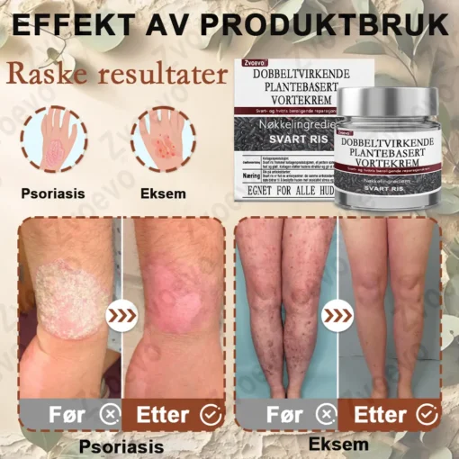 Zvoevo® Svart ris hudreparerende essenskrem