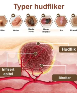 Zvoevo® Svart ris hudreparerende essenskrem
