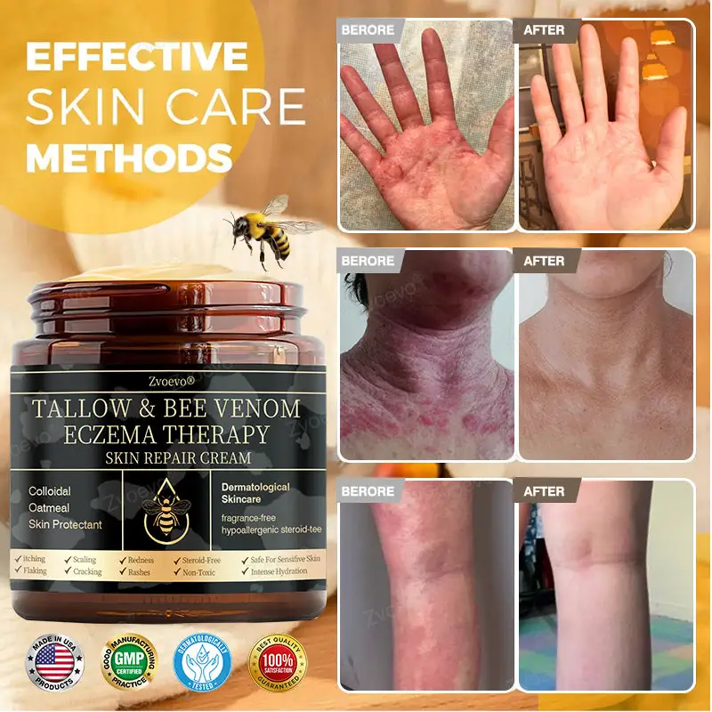 ๐๐ฏ๐จ๐๐ฏ๐จยฎ ๐๐๐ ๐๐๐ง๐จ๐ฆ & ๐๐๐ญ๐ฎ๐ซ๐๐ฅ ๐๐๐ฅ๐ฅ๐จ๐ฐ ๐๐ค๐ข๐ง ๐๐๐ฉ๐๐ข๐ซ ๐๐ซ๐๐๐ฆ